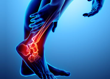 Physical Therapy for Ankle and Foot Pain - Fast Track Physical