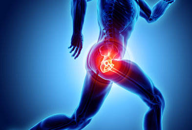 Hip Pain - Recover Physio Hastings